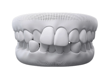 invisalign before after