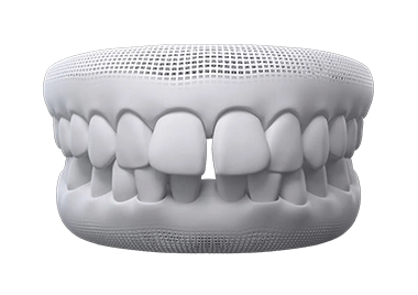 invisalign before after